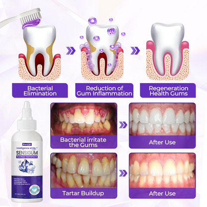 Fluoride Toothpaste