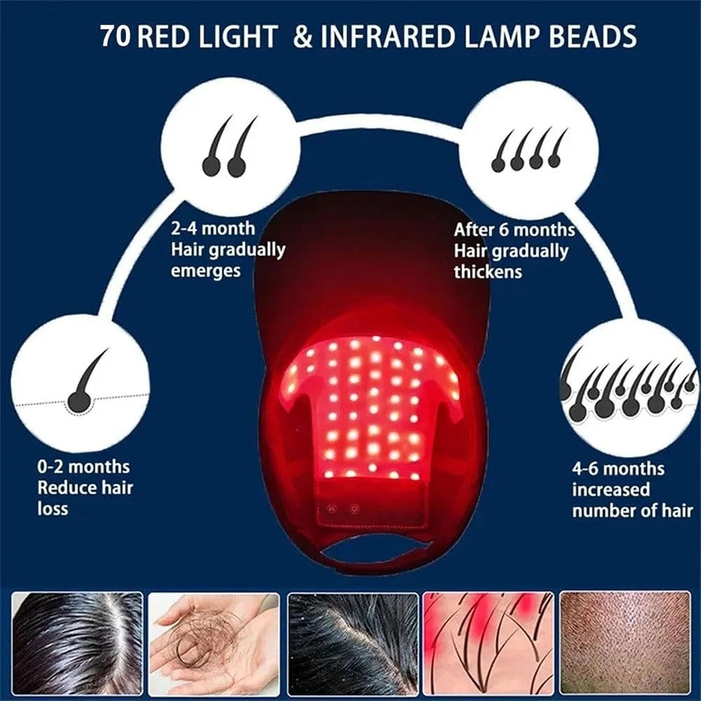 🔥HOT SALE 49% OFF🔥Red light hair growth cap, 70 LED bulbs, scalp health light therapy cap