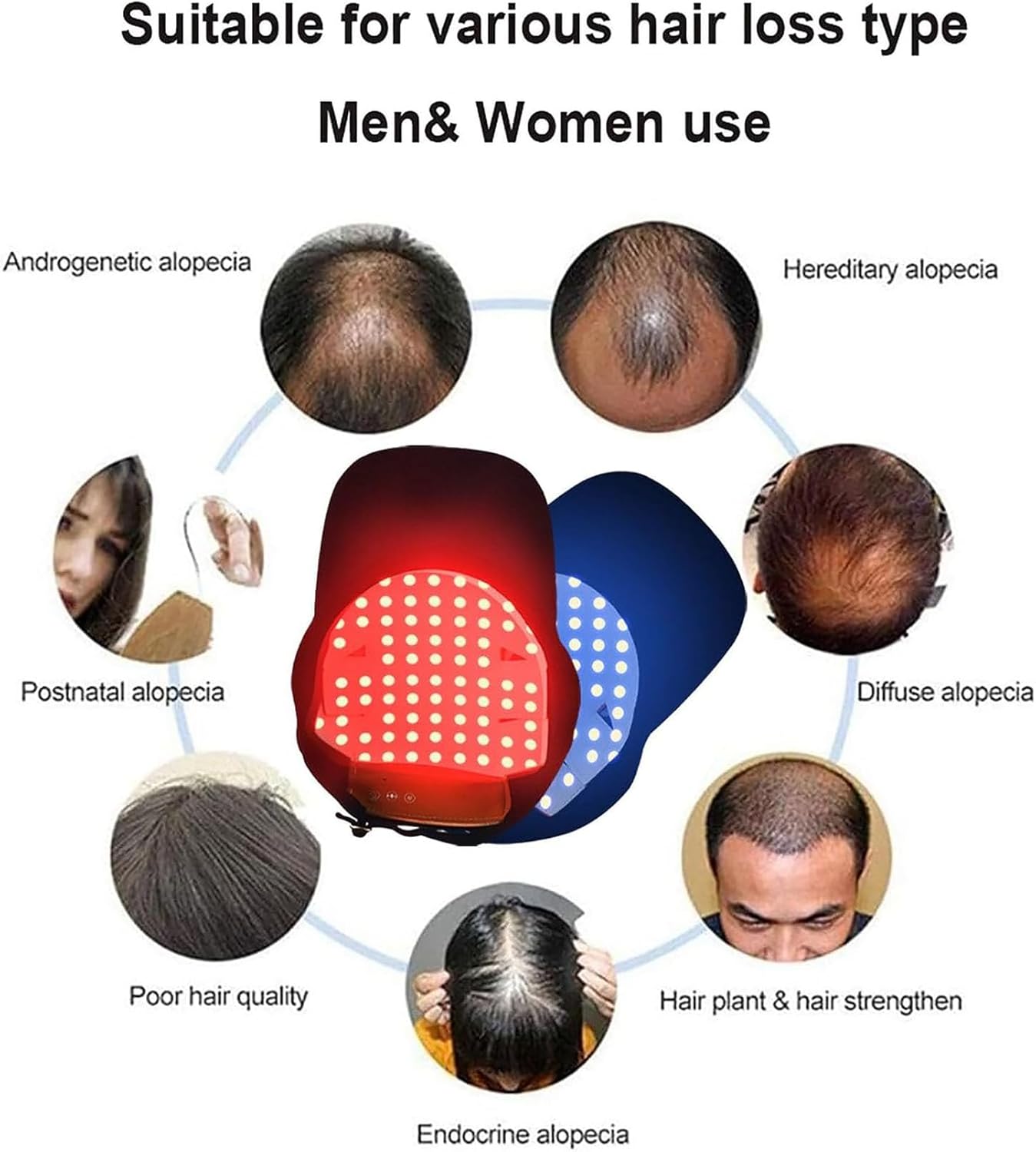 🔥HOT SALE 49% OFF🔥Red light hair growth cap, 70 LED bulbs, scalp health light therapy cap