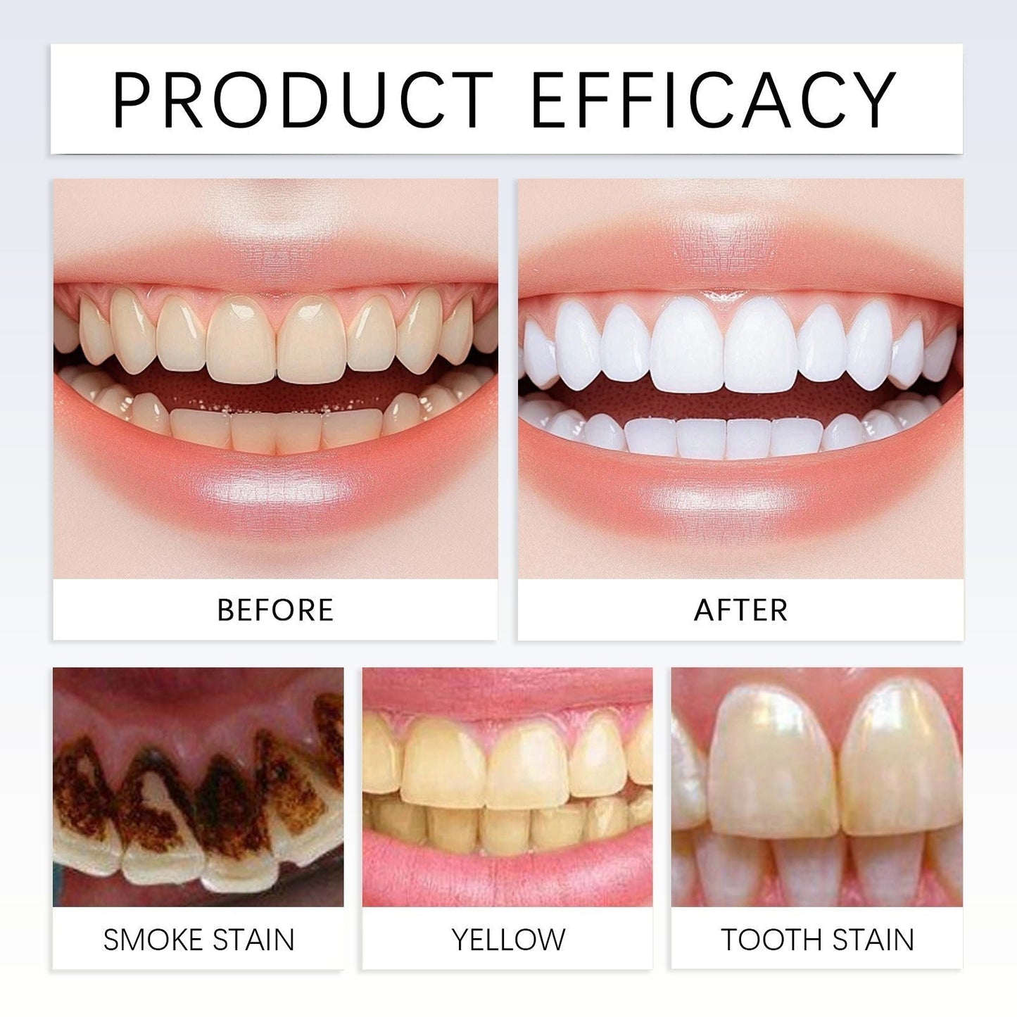 Oral Care Toothpaste, Fresh Breath, Prevent Tooth Loss