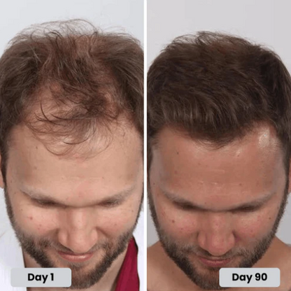 🔥HOT SALE 49% OFF🔥Red light hair growth CAP